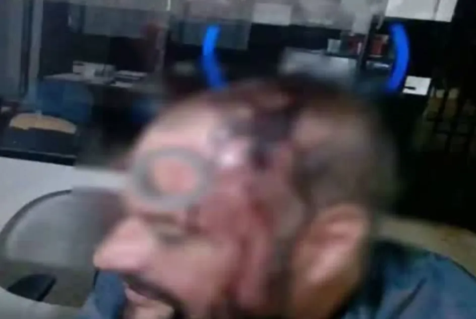 Homem denuncia namorada por agressão após discussão no bairro Formosinha